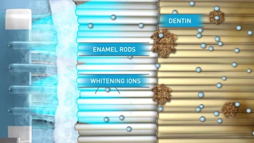 Sonic Blue Teeth Whitening System - image 8 from the video