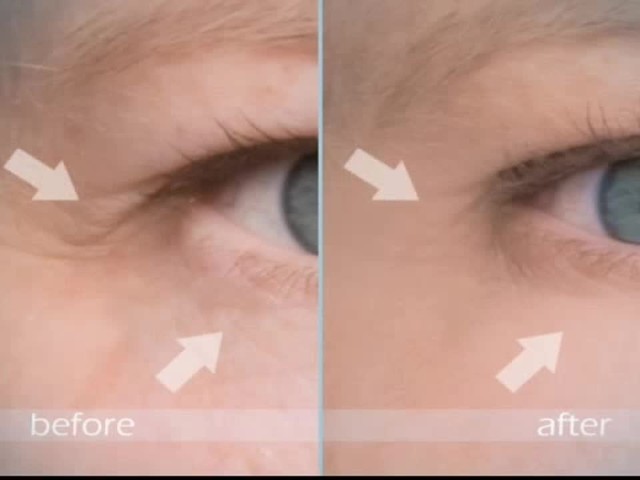 Cellceuticals Testimonials - image 2 from the video
